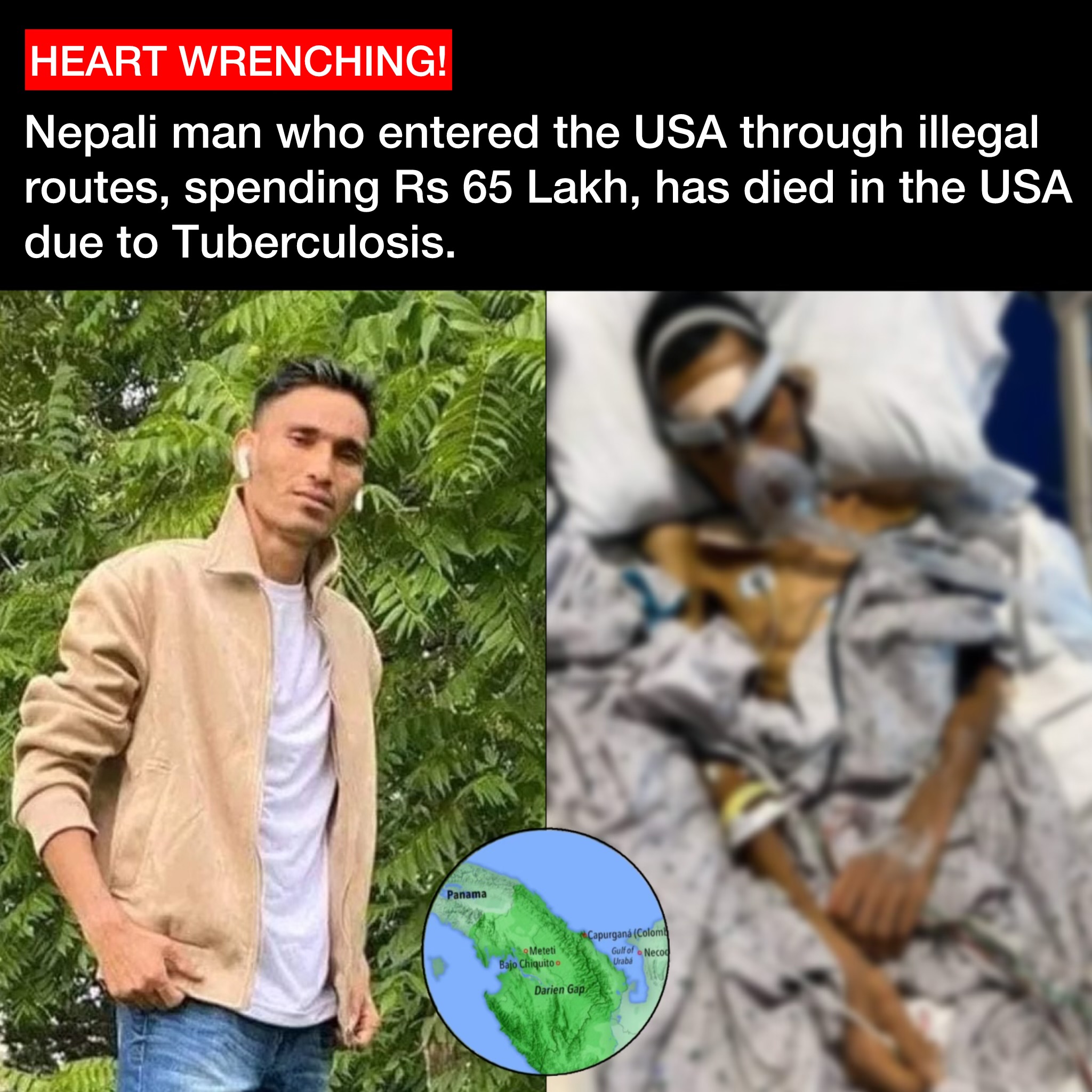 Nepali Man Who Entered The USA Illegally at Rs 65 Lakh Dies Due Tuberculosis